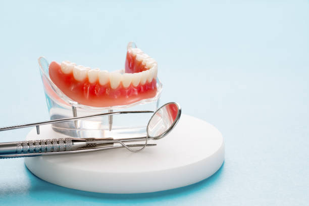 Full Mouth Reconstruction in San Mateo, CA